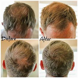 Trichologen™ Peptide Hair Growth Serum